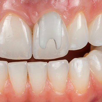 Cherilyn Sheets, DDS, FACP